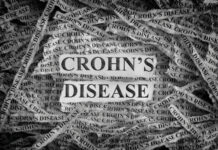 Can Crohn’s Disease Cause Constipation? What Patients Should Know Can Crohns Disease Cause Constipation