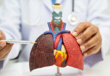 Can Lung Cancer Be Silent? What “No Symptoms” Really Means Can Lung Cancer Be Silent