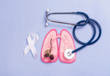 Lung Cancer in Non-Smokers: How It’s Different Lung Cancer in Non-Smokers How Its Different