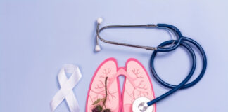 Lung Cancer in Non-Smokers: How It’s Different Lung Cancer in Non-Smokers How Its Different