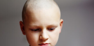Alopecia in Children: How Hair Loss Affects Kids, Parents & What to Do Next Alopecia in Children