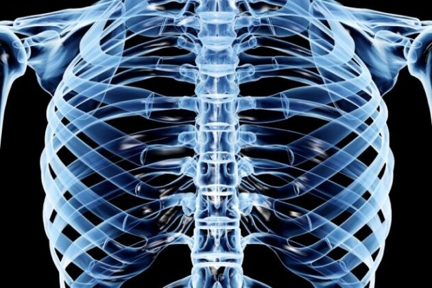 Understanding the Wide Ribcage: Causes, Implications, and Management