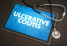 Diet for Ulcerative Colitis: What to Eat and Avoid to Manage Flares Naturally Diet for Ulcerative Colitis