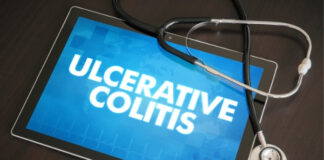 Diet for Ulcerative Colitis: What to Eat and Avoid to Manage Flares Naturally Diet for Ulcerative Colitis