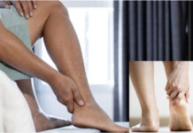 How to Prevent Achilles Tendonitis: Footwear, Workout Tips and Daily Habits How to Prevent Achilles Tendonitis