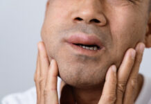 How to Reduce Angioedema Swelling: Home Remedies and Medical Treatments That Help How to Reduce Angioedema Swelling