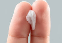 Is Cloudy Vaginal Discharge Normal? Understanding Causes, Colors, and When to See a Doctor Is Cloudy Vaginal Discharge Normal Understanding Causes Colors and When to See a Doctor