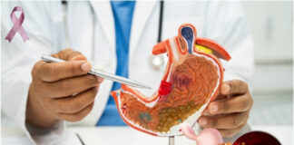 Strategies to Reduce Your Stomach Cancer Risk During Awareness Month Strategies to Reduce Your Stomach Cancer Risk During Awareness Month