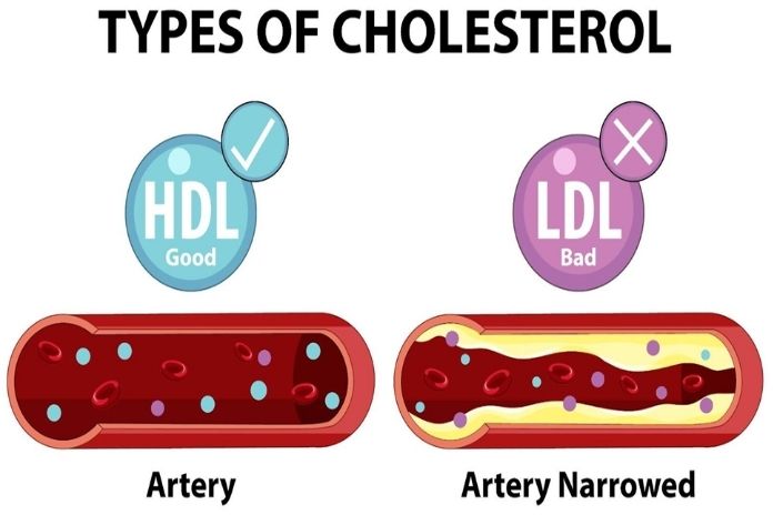 Understanding Cholesterol Changes During Menopause