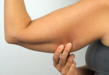 How to Get Rid of Bat Wings — Causes, Workouts & Science-Backed Tips for Toned Arms How to Get Rid of Bat Wings Causes Workouts