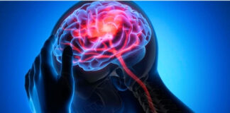 When Mild Headaches Are More Than They Seem: An In-Depth Look at Chronic Migraine & Its Treatment When Mild Headaches Are More Than They Seem