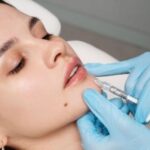 How Long Does Lip Filler Last? Timeline, Factors, and What to Expect How Long Does Lip Filler Last