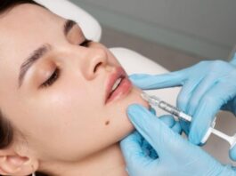 How Long Does Lip Filler Last? Timeline, Factors, and What to Expect How Long Does Lip Filler Last