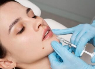 How Long Does Lip Filler Last? Timeline, Factors, and What to Expect How Long Does Lip Filler Last