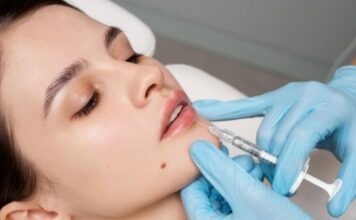 How Long Does Lip Filler Last? Timeline, Factors, and What to Expect How Long Does Lip Filler Last