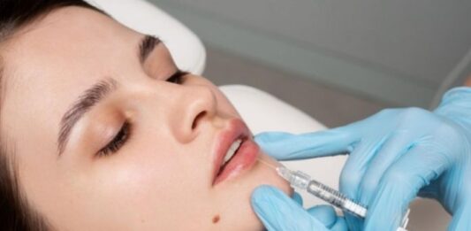 How Long Does Lip Filler Last? Timeline, Factors, and What to Expect How Long Does Lip Filler Last