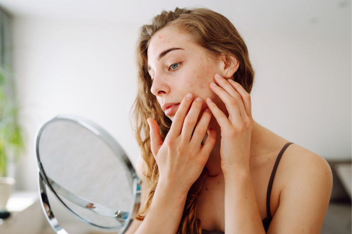 The Real Impact of Alcohol on Skin Health