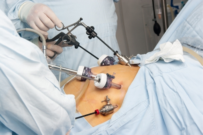 Anemia After Gastric Bypass How to Manage Low Iron When Your Gut Wont Absorb It Properly Anemia After Gastric Bypass How to Manage Low Iron When Your Gut Wont Absorb It Properly