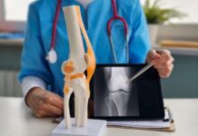 Best Foods for Bone Density: What to Eat to Keep Your Bones Strong as You Age Best Foods for Bone Density