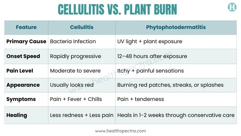 Comparison Table Cellulitis vs Plant Burn