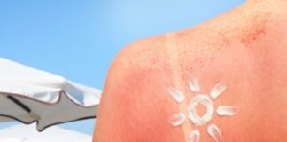 Don’t Pop Sunburn Blisters: The Safe Way to Treat Them (And Why Petroleum Jelly Helps Healing) Don’t Pop Sunburn Blisters