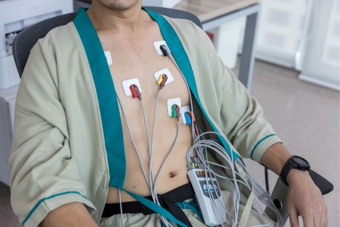 How to Detect Arrhythmias That Come and Go