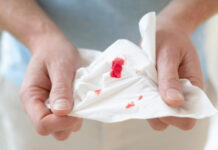 Is Unusual Bleeding a Sign of Cancer? What It Could Mean and When to See a Doctor Is Unusual Bleeding a Sign of Cancer