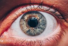 Living With Diabetic Macular Edema: What to Expect, How to Cope, and What Treatment Really Looks Like Living With Diabetic Macular Edema