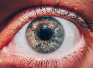 Living With Diabetic Macular Edema: What to Expect, How to Cope, and What Treatment Really Looks Like Living With Diabetic Macular Edema