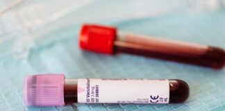 Lymphoma vs. Leukemia: How the Origin of Your Cancer Shapes Diagnosis, Symptoms, and Treatment Lymphoma vs. Leukemia