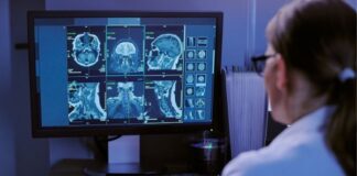 MRI Scans Show Exercise Can Make Your Brain Look Younger MRI Scans Show Exercise Can Make Your Brain Look Younger