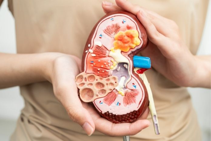 Practical Tips for Reducing Kidney Stone Risk Naturally