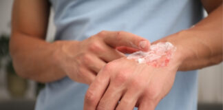 Scars & Slow Healing: How Vitamins C and D Support Faster Skin Repair and May Reduce Scarring Scars Slow Healing How Vitamins C and D Support Faster Skin Repair