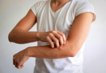 Spring Allergies or Chronic Hives? How to Tell if It’s Chronic Spontaneous Urticaria Spring Allergies or Chronic Hives