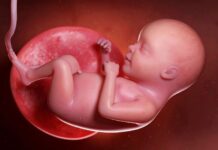 What Is a Bicornuate Uterus? Causes, Diagnosis, and What It Means for Pregnancy What Is a Bicornuate Uterus