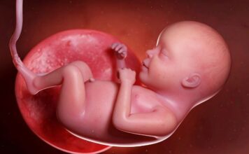 What Is a Bicornuate Uterus? Causes, Diagnosis, and What It Means for Pregnancy What Is a Bicornuate Uterus