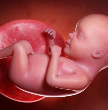 What Is a Bicornuate Uterus? Causes, Diagnosis, and What It Means for Pregnancy What Is a Bicornuate Uterus