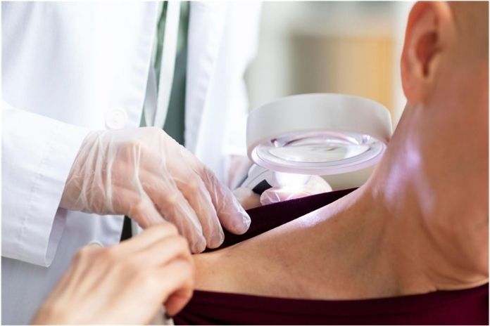 When to See a Dermatologist