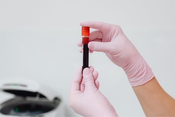 When to Seek Medical Evaluation