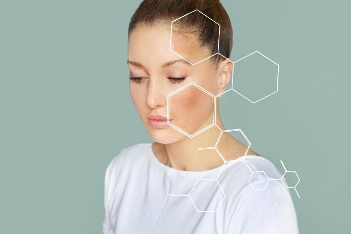Why Periorbital Skin Is So Hard to Treat