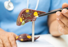 3 “Liver Support” Teas That May Harm Your Liver 3 Liver Support Teas That May Harm Your Liver
