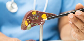 3 “Liver Support” Teas That May Harm Your Liver 3 Liver Support Teas That May Harm Your Liver