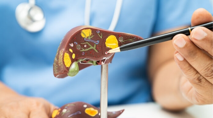 3 “Liver Support” Teas That May Harm Your Liver 3 Liver Support Teas That May Harm Your Liver