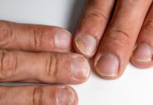Fingernail Problems Not to Ignore: What Your Nails Are Telling You Fingernail Problems Not to Ignore