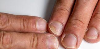 Fingernail Problems Not to Ignore: What Your Nails Are Telling You Fingernail Problems Not to Ignore