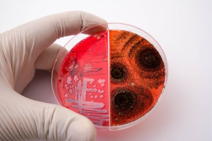 Hidden Bacteria 2 Bacterial Vaginosis-Associated Organisms