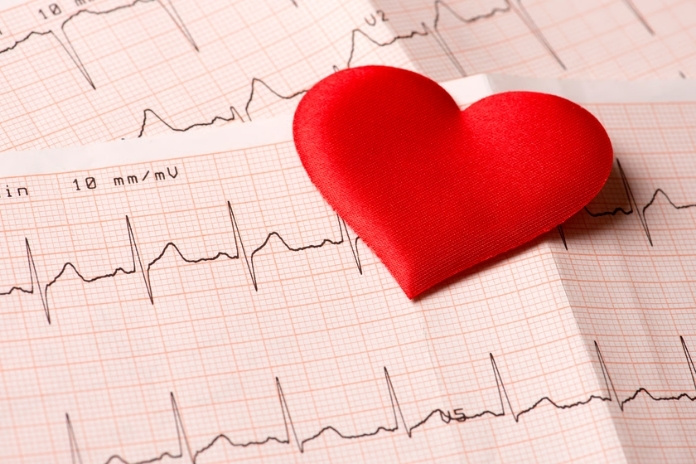 Holter Monitor vs Event Recorder Holter Monitor vs Event Recorder