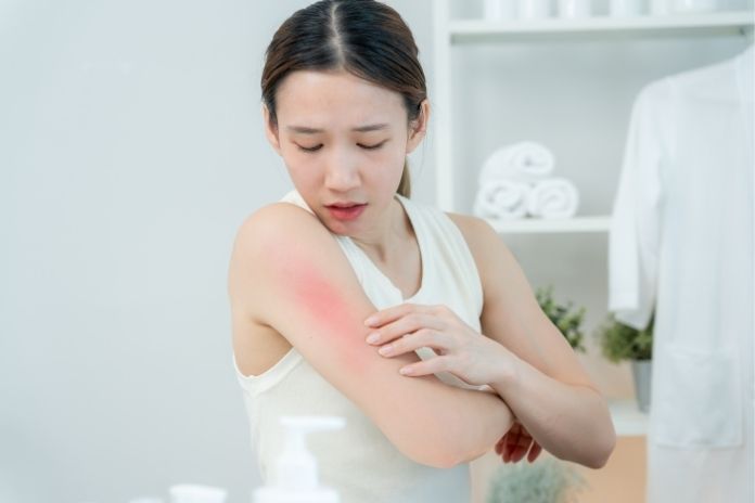 How to Tell If a Sunburn Product Is Safe for Sensitive Skin