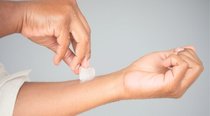 Is Skin Icing Damaging Your Skin Barrier? What Dermatologists Want You to Know Is Skin Icing Damaging Your Skin Barrier