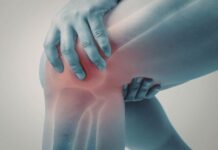 More Than Skin Deep: Why Your Psoriasis Patch and Your Aching Knees Are Connected More Than Skin Deep